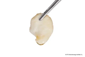 Bone regeneration for implants 1