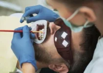 Dental Bridge Repair Explained – What You Need to Know