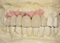 Dental Reconstruction Techniques to Restore Your Smile’s Integrity