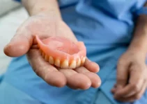 Dentures on Implants Explained – Benefits and Process