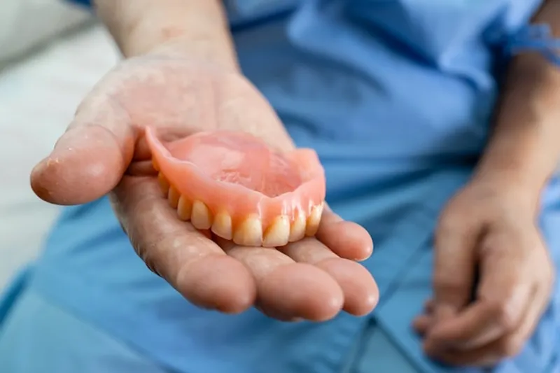 Dentures on implants 1