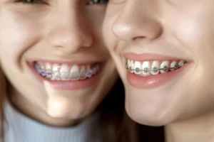 Invisalign vs. Braces Choose the best option for your smile 1