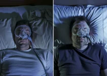 Before and After CPAP Machine: Understanding Changes in Sleep Quality and Health