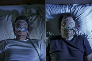 before and after cpap machine 1