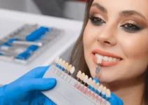 Dental Veneers Explained: Enhance Your Smile with Modern Solutions