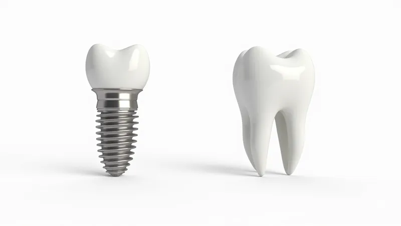 dental implant vs natural tooth differences and key facts to understand